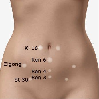 puntos de acupuntura para adelgazar abdomen