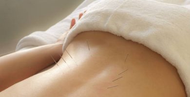 acupuntura para el dolor de espalda